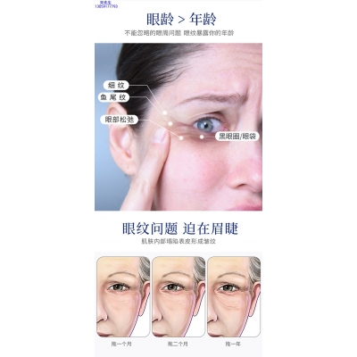 馨妍_美容院玻尿酸微针眼贴